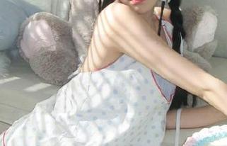 First Image