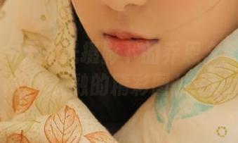 First Image